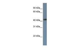 ZNF669 Rabbit anti-Human, Polyclonal, Novus Biologicals 100 &mu;g | Buy Online | Novus Biologicals | Fisher Scientific